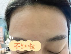 体验后-来美轻医美抗衰中心