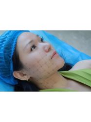 -上海伊莱美医疗美容医院