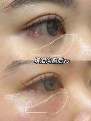 -肌密·水光·祛痘·黄金微针