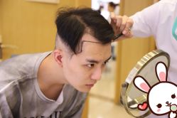 -大麦微针植发丨全国连锁