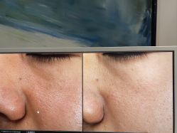 -苑苑vbeauty科技美容SPA