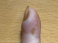 -新甲连锁灰指甲·甲沟炎·鸡眼(黑龙江路店)