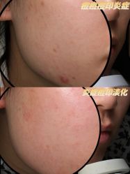-Yestar重庆艺星医疗美容医院