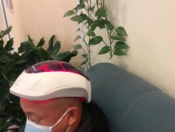 -碧莲盛·不剃发植发