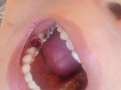 -优诺口腔·VIP尊享中心(爱建机构)