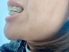 -新达口腔(华东理工大学店)