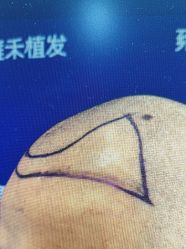 -雍禾植发全国连锁