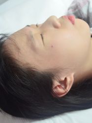 -清疣美疣·痣·斑净肤中心