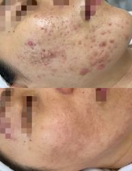 -康美贞·痘肌养护管理中心