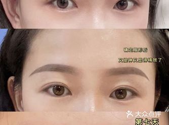 7月份的时候，四七美学来无锡巡诊，过去纹眉了