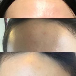 -苗方清颜痘肌研究所