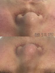 -蕾特恩专业祛痘·皮肤管理