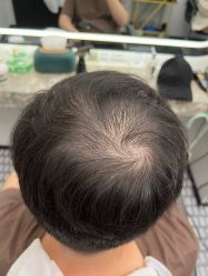 -唐风采假发补发定制