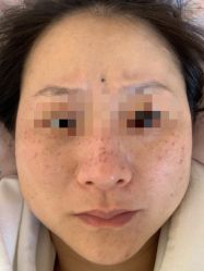 体验后-德媛医疗美容