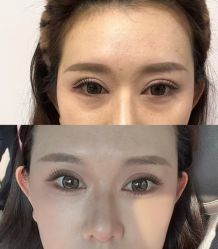 点击看大图 -Yestar艺星医疗美容医院