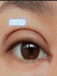 -美莱医学美容医院