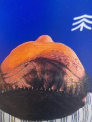 体验前-雍禾植发全国连锁