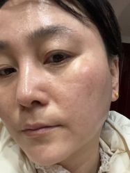 体验前-南京医科大学友谊整形外科医院