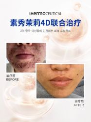 -苗方清颜痘肌研究所