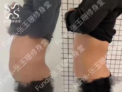 -Fundi张玉珊修身堂·indiba·BTL科技瘦身