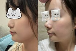 -JustHer宁波珈禾医疗美容医院