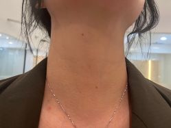 -郡艺医疗美容·微整·眼鼻吸脂