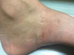 -成都军建医院·疤痕诊疗中心