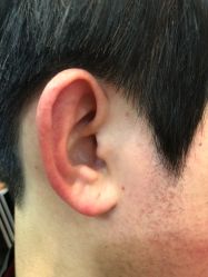 体验后-洁铭新加坡医美