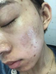 -休美安专业皮肤修复管理中心