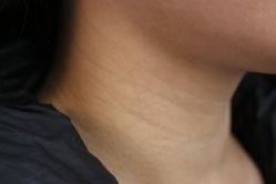 -丰联丽格医疗美容·联合丽格眼整形中心