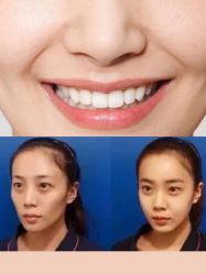 -美莱医学美容医院