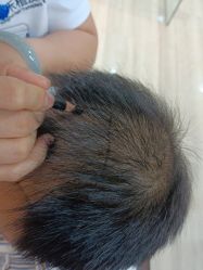 -雍禾植发全国连锁