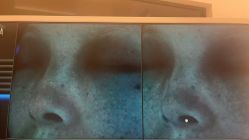 -苑苑vbeauty科技美容SPA
