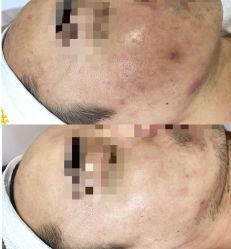 -康美贞·痘肌养护管理中心