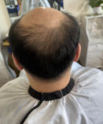 -极客侠男士假发定制补发