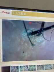-菩叶脱发白发中心