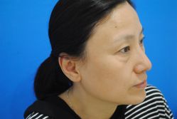 -天津健丽·去眼袋医疗美容机构