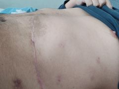 -中国人民解放军总医院(301医院)