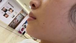 -长沙雅美医疗美容医院