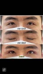 -联合丽格·张菡丽格医疗美容