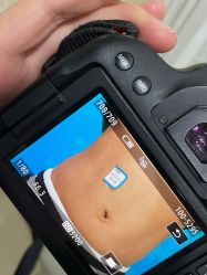 体验前-重庆军科整形美容医院