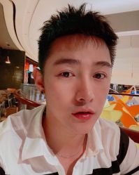 点击看大图 体验后-大麦微针植发全国连锁