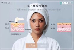 -韩国淼美颜皮肤管理官方直营店