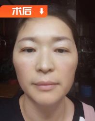 -素美医疗美容·西南眼鼻整形·修复基地