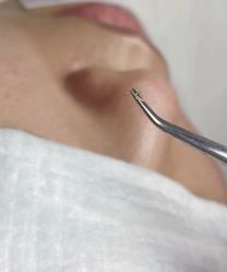 -Cream88颜皮肤管理中心