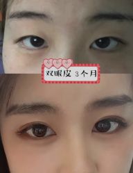 -上海漾颜医疗美容