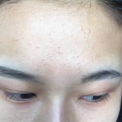 -苗方清颜痘肌研究所