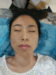 android_upload_pic-哈尔滨瑞丽医疗美容医院