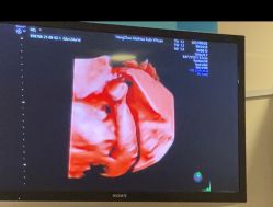 -杭州贝瑞斯美华妇儿医院·早孕·产检·儿科