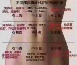 -香薇妮丝女子减肥院